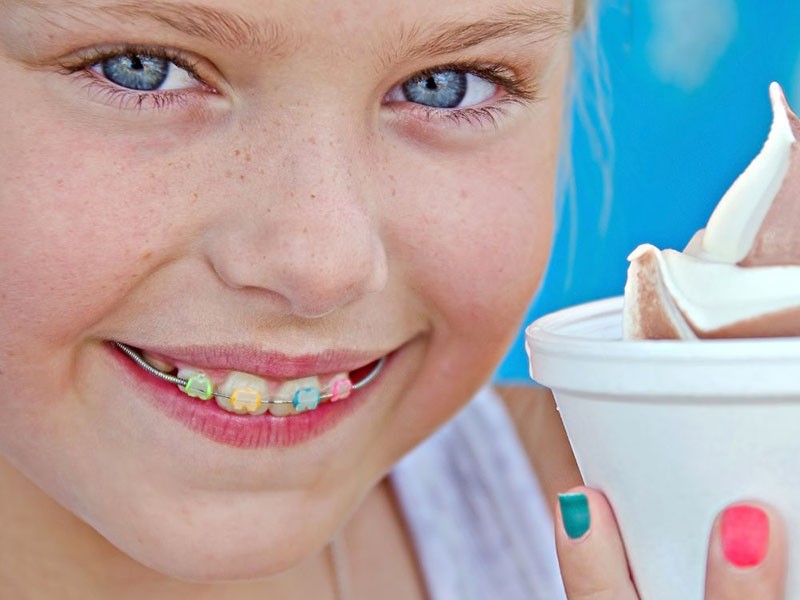 5 ok, amiért érdemes a gyermek fogszabályozást nyáron elkezdeni