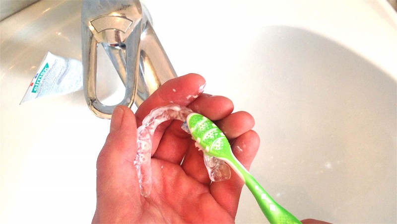 Hogyan tisztítsuk a láthatatlan fogszabályozót