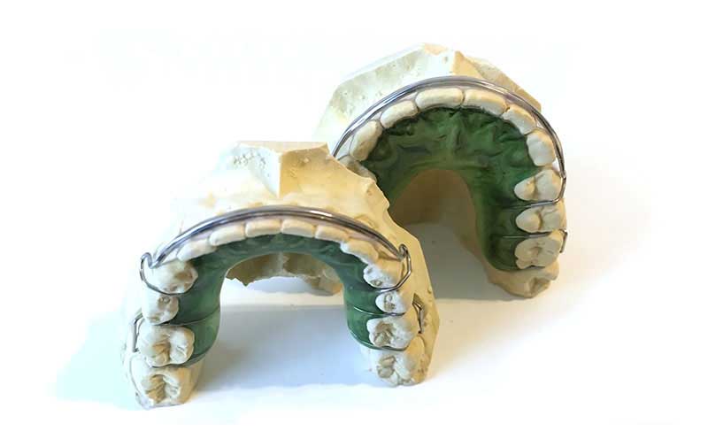 Traditional Orthodontics