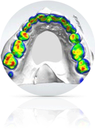 HappySmile invisible orthodontics treatment, 3d modeling